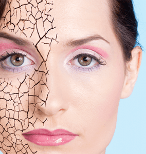 Preventing dry skin