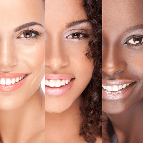 Does skin tone affect wrinkles?