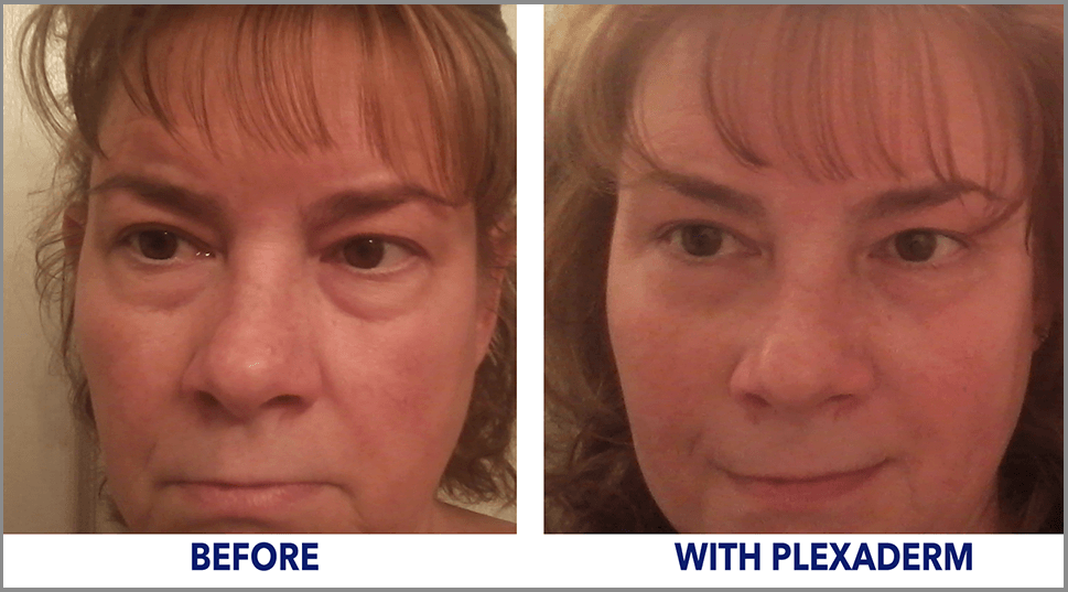Cindy experiences amazing results