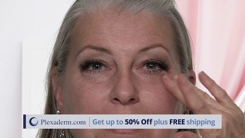 Amazing Plexaderm Before and After