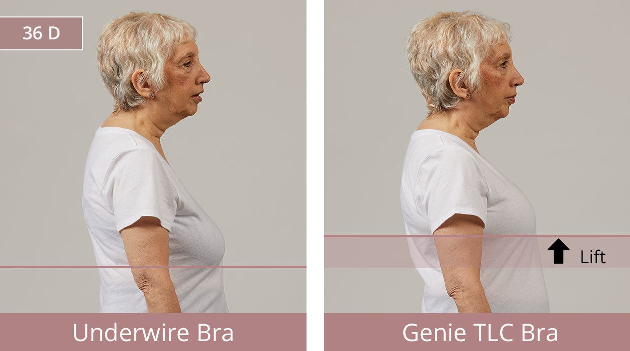 Before & After: Paula