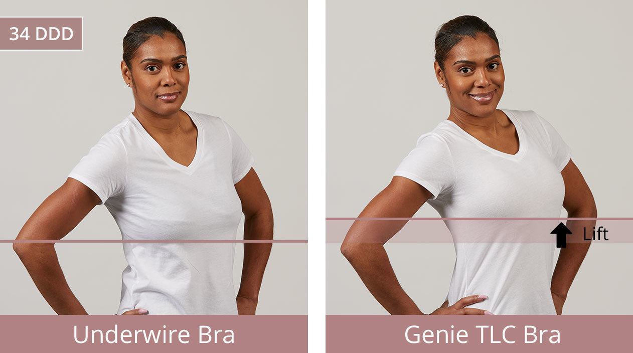 Before & After: Aishah