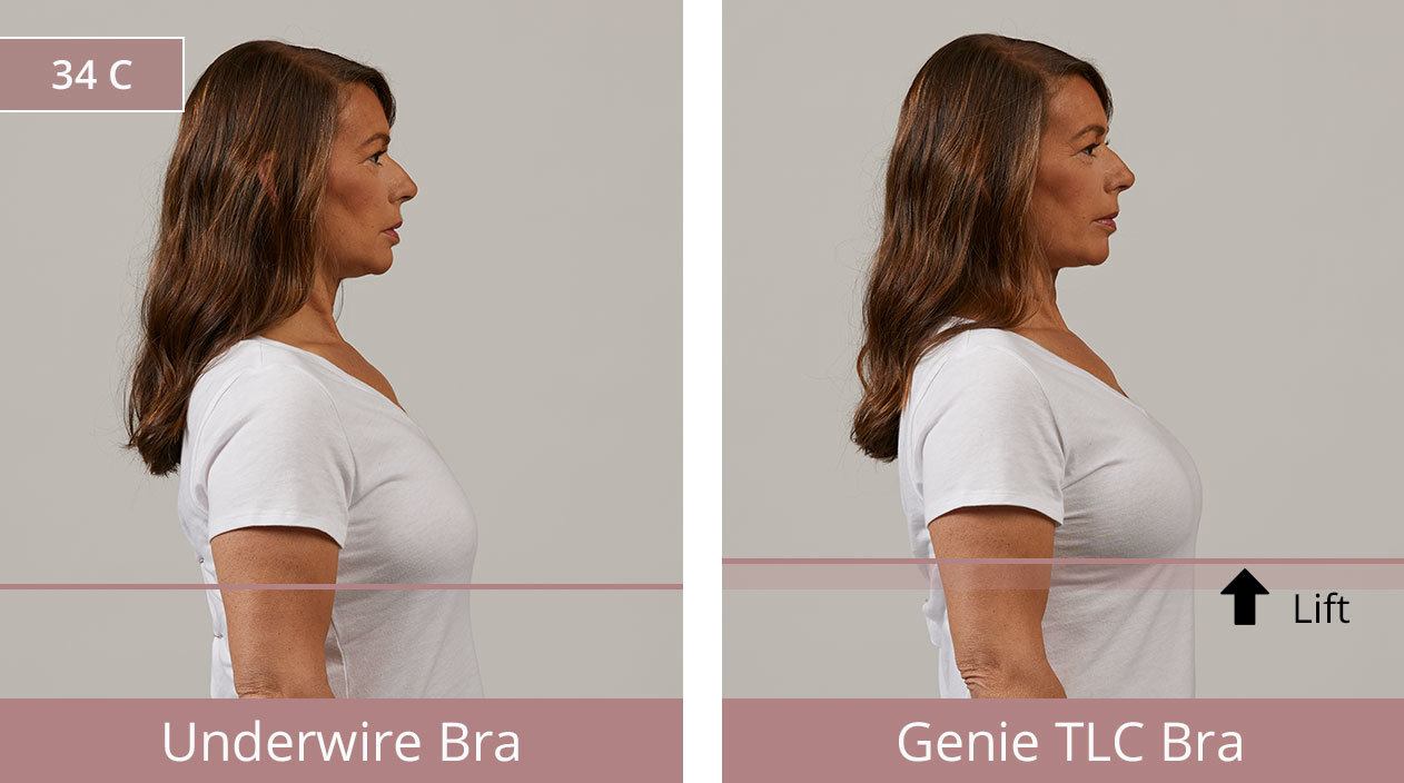 Before & After: Jodi