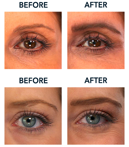 Before and After Designer Brows - Classic