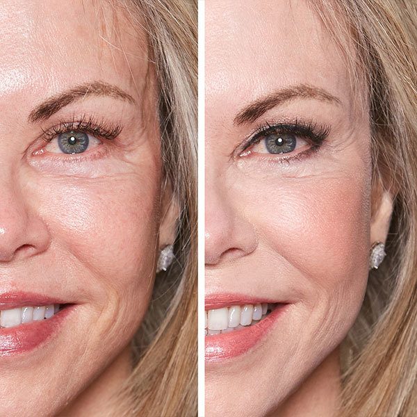 Before and After of Older Woman with Blonde Hair