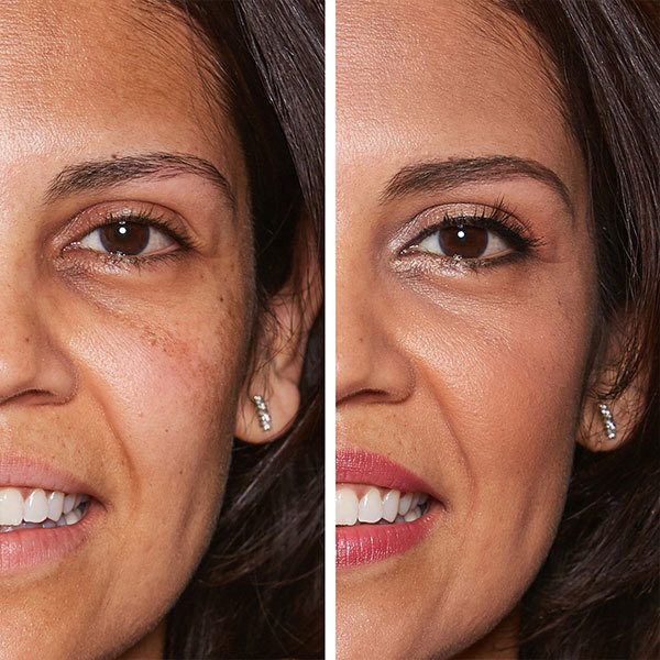 Before and After of Middle Aged Woman with Brown Hair